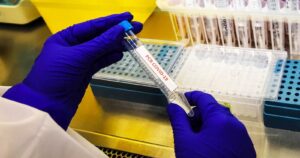 COVID-19: Minsal informa más de 8 mil casos nuevos y 185 fallecidos