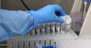 Minsal reportó más de 4 mil casos nuevos de COVID-19 y positividad superior al 14% en la Región Metropolitana