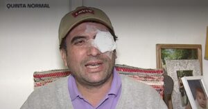 Candidato a concejal de RN por Quinta Normal recibe balín en el ojo durante cierre de campaña