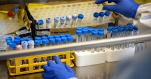 Estudiante de Viña del Mar fue el segundo caso de la variante delta en Chile