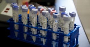 Minsal reportó más de 3 mil casos nuevos de COVID-19 y baja en la positividad