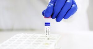 Detectan nueva variante de COVID-19 en Río de Janeiro