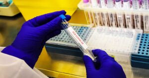 Minsal reportó menos de 3 mil casos nuevos de COVID-19 y positividad del 6%