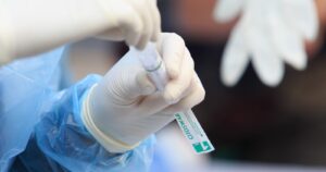 Balance COVID-19: Minsal reportó la segunda cifra más alta con 8.867 casos