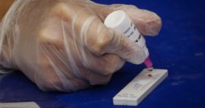 Anuncian operativos con exámenes de VIH en el Velódromo del Estadio Nacional