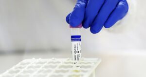 Minsal reportó menos de 2 mil casos nuevos de COVID-19 y positividad del 5%