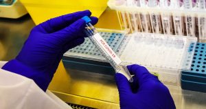 Balance COVID-19: Minsal reportó la cifra de casos activos más baja desde mayo de 2020