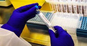 Balance COVID-19: Minsal reportó 1.656 casos nuevos y una baja en la positividad