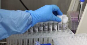 COVID-19: Minsal reportó más de 2 mil casos nuevos y positividad a la baja