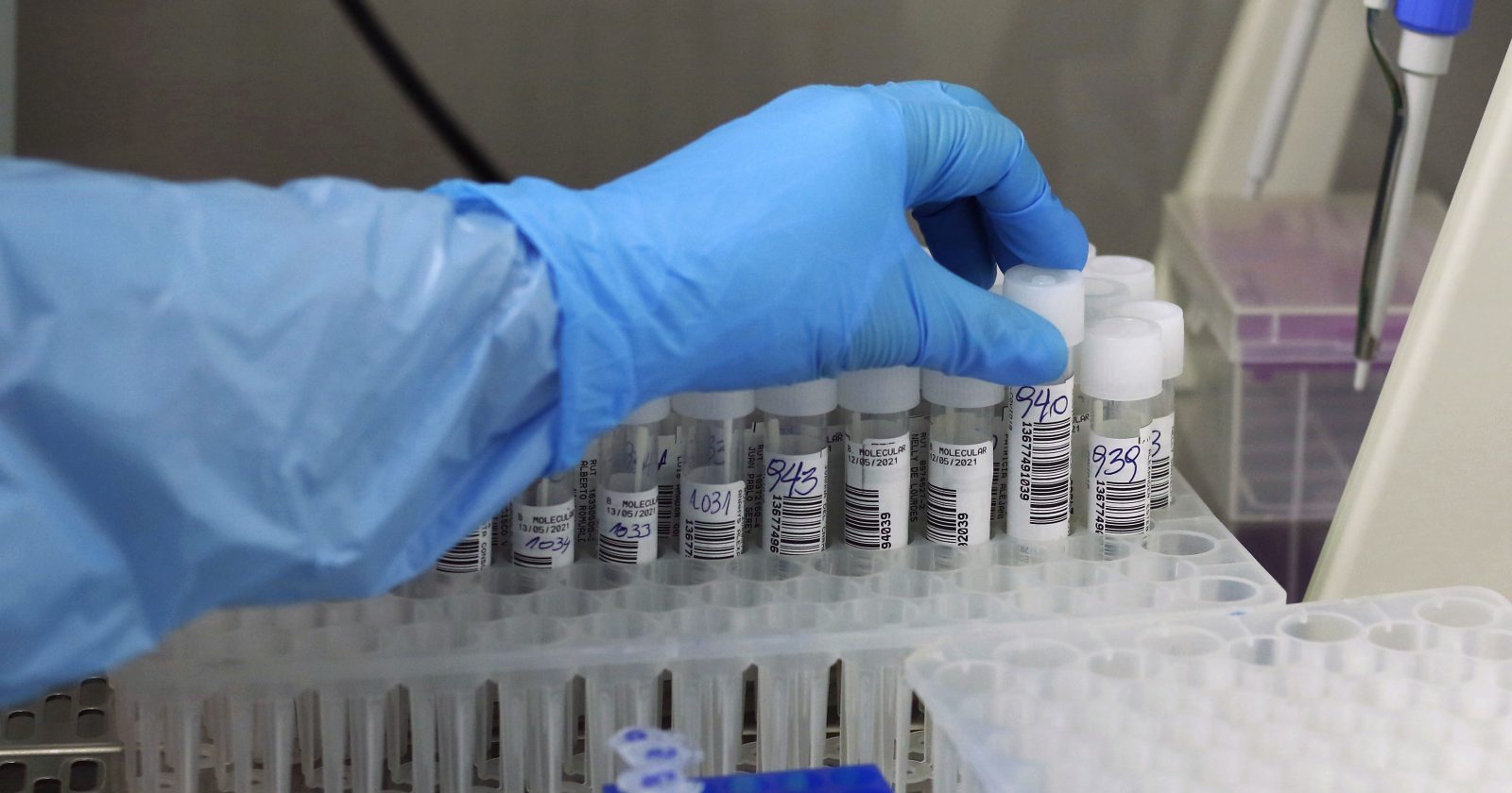 casos positividad baja