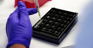 COVID-19: Minsal reportó 315 casos nuevos y positividad del 1,2%