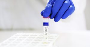 COVID-19: positividad alcanzó el 0,98%, la cifra más baja de la pandemia