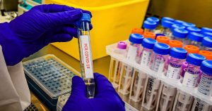 COVID-19: Minsal reportó 754 casos nuevos y nuevo récord de baja en positividad