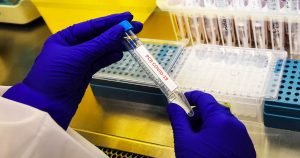 Balance COVID-19: Minsal reportó 868 casos nuevos y positividad menor al 2%