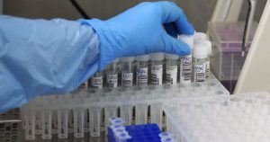 Minsal reportó 405 casos nuevos de COVID-19 y positividad de 1% en la Región Metropolitana