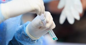 COVID-19: Minsal reportó 526 casos nuevos y una leve baja en la positividad