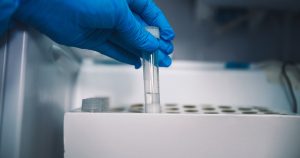 Balance COVID-19: Minsal reportó más de 10 mil casos activos