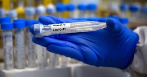 Contacto estrecho de primer caso de ómicron en Chile da positivo por la misma variante