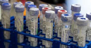 Covid: Rusia roza los 33.000 casos diarios con más de 1.200 muertos en últimas 24 horas