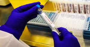 Seremi de Salud del Biobío confirma el primer caso de variante ómicron en la región