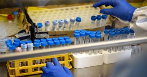 Argentina rompe un nuevo récord con 81 mil casos de COVID-19