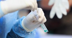 Minsal corrigió error en positividad en Antofagasta: informó 32%, pero fue de 5%