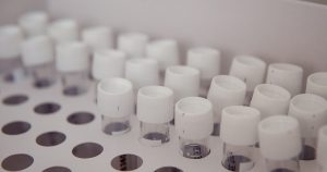 Minsal: segundo día consecutivo con más de 4.000 casos COVID