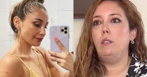 Mujer denuncia a Daniela Castro luego que uno de sus perros la mordiera en el rostro