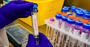 Francia suma por primera vez en pandemia más de medio millón de casos en un día