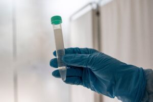 COVID-19: Minsal reportó 18.326 casos nuevos y 132 fallecidos