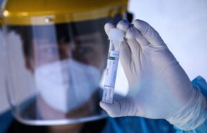 Confirman primer caso de viruela del mono en Argentina