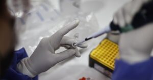 Minsal informa dos nuevos casos de viruela del mono y contagiados a nivel nacional llegan a ocho