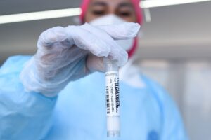 Balance COVID-19: Minsal reportó 9.101 casos nuevos y positividad del 14,33%