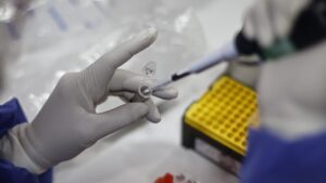 Casos de viruela del mono en el país escalan a 13 y Minsal descarta transmisión comunitaria