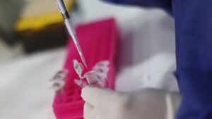 OMS declara emergencia sanitaria internacional por aumento de casos de Viruela del Mono