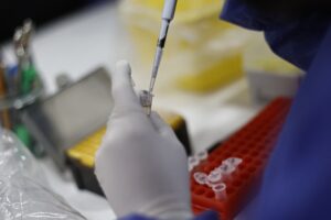 Viruela del mono en América Latina: Brasil y Chile entre los países con más casos