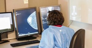 Cáncer de mama: estudio revela diferencias en la sobrevida según tipo de previsión de salud