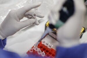Minsal reportó la primera muerte por viruela del mono en Chile