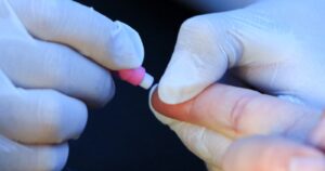 Sida: cuando el diagnóstico precoz es fundamental