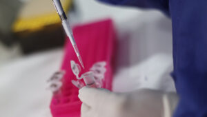 Ministerio de Salud amplía grupo objetivo de vacunación contra la viruela del mono