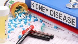 Ocho reglas de oro para cuidar los riñones y prevenir la enfermedad renal
