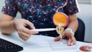 Desarrollan en Chile tratamiento médico de precisión para casos avanzados o metastásicos de cáncer de vejiga