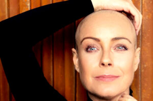 La última terapia y los plazos de cuándo Claudia Conserva podría regresar a la TV