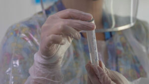 Especialistas aclaran: es prácticamente imposible erradicar la tuberculosis en Chile