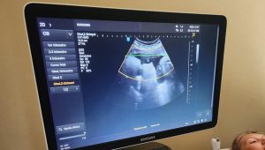 Tendencia de traer mujeres rusas para tener sus hijos en Argentina aterriza en Viña del Mar