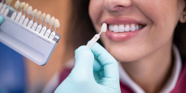 Blanqueamiento dental