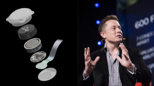 Chip cerebral de Neuralink: cómo se implanta y qué promete