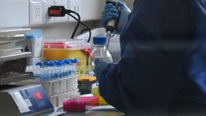 Ministerio de Salud decreta Alerta Sanitaria Preventiva por Viruela del Mono