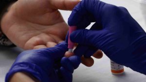 Día Mundial contra el VIH: solo el 70% de las personas que viven con el virus en Chile está en tratamiento