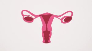 Lo que debes saber sobre el cáncer de ovario: una amenaza silenciosa para la salud femenina